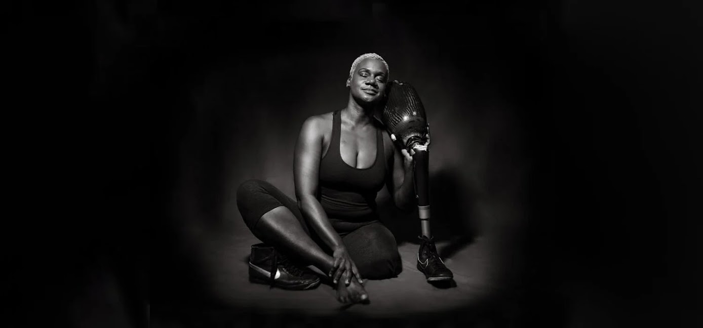 A black and while image of a short blonde-haired black female who is an above-the-knee amputee. She is sitting on the ground with her eyes closed, with her right leg bent with right hand touching her leg. On her left, she hugs her prosthetic leg, resting her head on the socket.